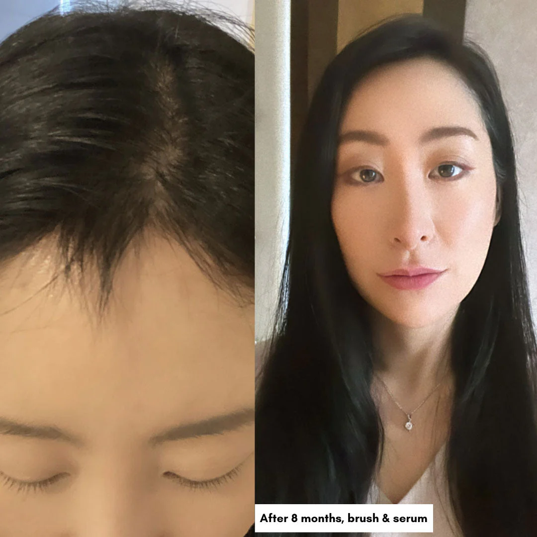 Hair & Scalp Revitalizing Set - Image 5